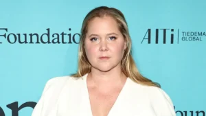 amy schumer Diagnosed with Cushing Syndrome